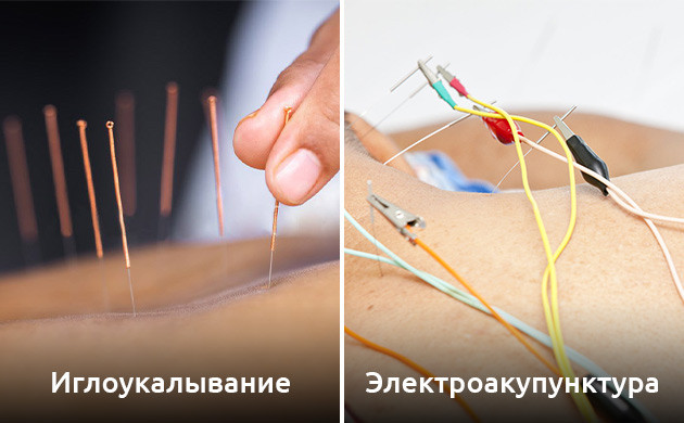 Иглоукалывание при опиоидной зависимости