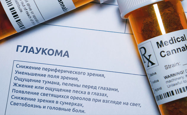 Признаки глаукомы: когда обращаться к врачу